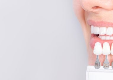 Estética Dental